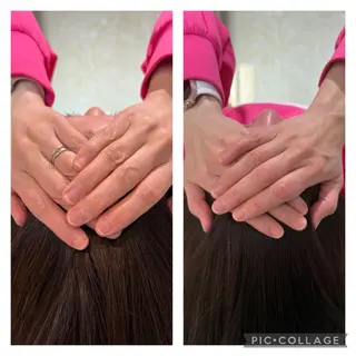 小顔矯正 MEGUMIのエステ・リラクイメージ