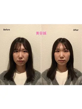 チキバン美容鍼灸整体 サロン心斎橋店のエステ・リラクイメージ