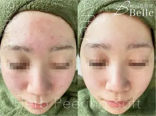 森 Belle目黒のエステ・リラクイメージ