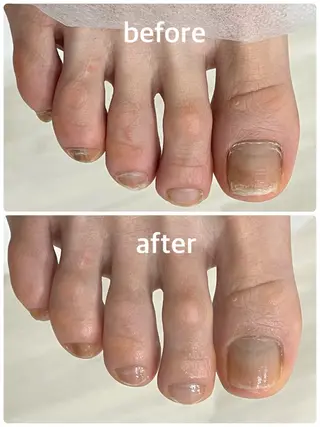 ネイル 足・爪トラブル専門店　foot grace所属・加藤 望のネイルデザイン