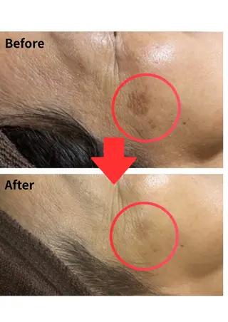 Belle White所属・本格痩身＊透明美肌 BelleWhiteのエステ・リラクイメージ