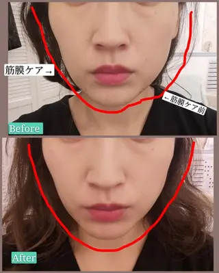 🅖🅤🅩🅔🅛 salonのエステ・リラクイメージ