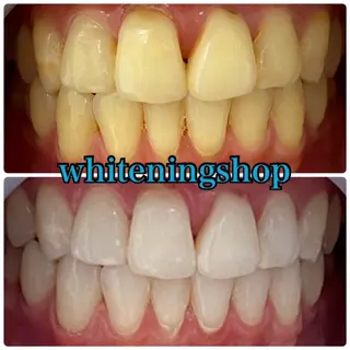 ホワイトニング ショップ吉祥寺店のエステ・リラクイメージ