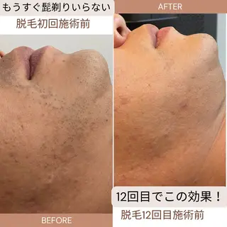 セルフエステエンリケ明石大久保店所属・夕希 毛穴と脱毛特化サロンのエステ・リラクイメージ