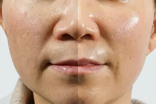 💐美肌/小顔づくり 🫧看護師🫧ASAのエステ・リラクイメージ