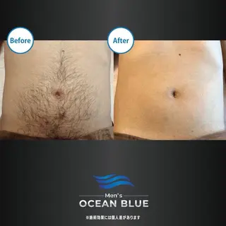 メンズ メンズオーシャンブルー福岡店所属・柿添 希実のエステ・リラクイメージ