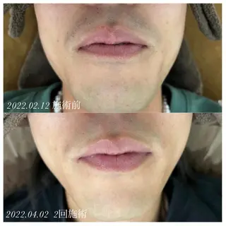 メンズ POIRE private salon(ポワール)所属・塚本 結の眉毛・アイブロウイメージ