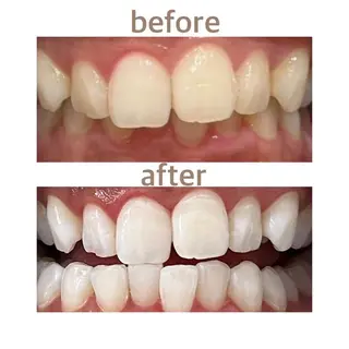 メンズ ホワイトニング ショップ本八幡店のエステ・リラクイメージ