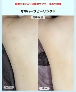 ベラージュ【美背中・ 美尻・フェイシャル】のエステ・リラクイメージ