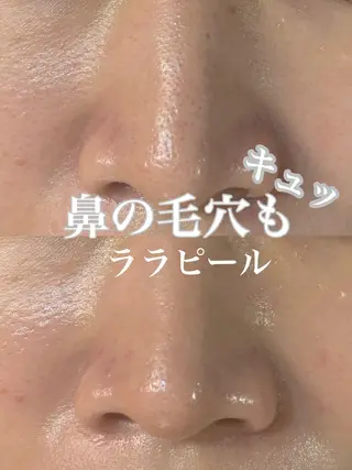 WHITE AQUA 北千住店のエステ・リラクイメージ