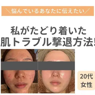 堀江リンパマッサージ 肩こり/リンパ/小顔のエステ・リラクイメージ