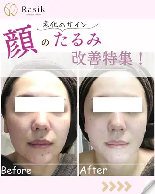 Rasik所属・Rasik 凜のエステ・リラクイメージ