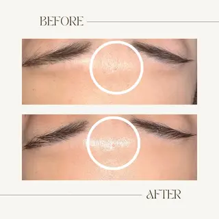 1st｜フェイシャル エステ専門店のエステ・リラクイメージ