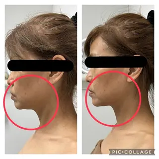 BeautySalonGemmy所属・Gemmy 愛美のエステ・リラクイメージ