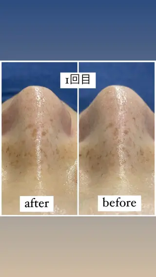 アルカンジュ~archange~所属・痩身/毛穴洗浄/脱毛 アルカンジュのエステ・リラクイメージ