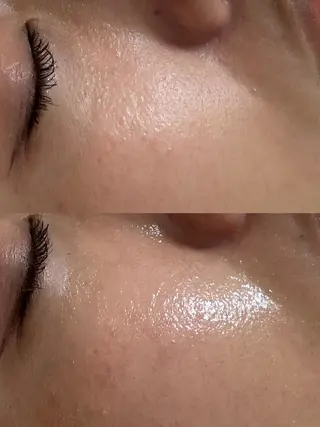 private salon éclat所属・ニキビ・毛穴専門 éclat/エクラのエステ・リラクイメージ