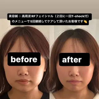 美容鍼灸サロンRemeリミー所属・美容鍼WINBACK サロンRemeのエステ・リラクイメージ