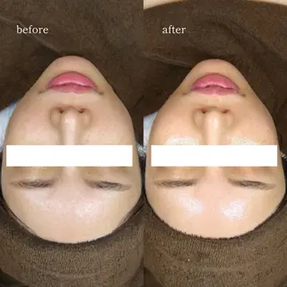 【韓国人肌製作所】 水光肌ならアーネストのエステ・リラクイメージ