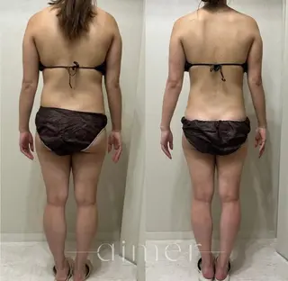 aimer 島田のエステ・リラクイメージ