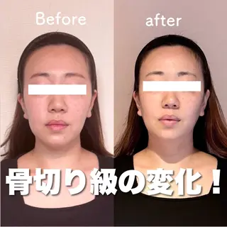 小顔矯正専門店Gémiey所属・越谷駅徒歩３分 小顔専門Gemieyのエステ・リラクイメージ