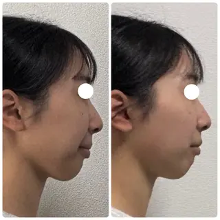 くつろぎ小顔サロン Lu mellow所属・片山けいこ| 美人顔創りの専門家のエステ・リラクイメージ