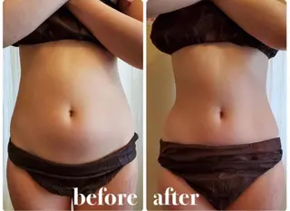 【大名】 NicoLのエステ・リラクイメージ