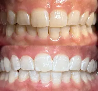 io teeth careのその他イメージ