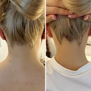 うなじ脱毛/美肌脱毛 LABELのエステ・リラクイメージ