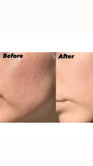 IRISE エステのエステ・リラクイメージ