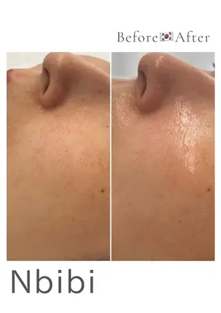 韓国🇰🇷価格 サロン_Nbibiのエステ・リラクイメージ