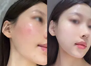 アイブロウ aliaハイフ&水光ジェットサロン所属・aliaハーブ水光店 エステティシャン募集のエステ・リラクイメージ