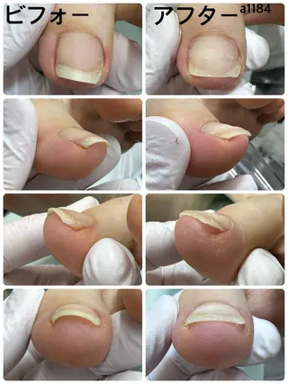 ネイル 巻き爪補正店枚方店所属・松本 猛史のネイルデザイン