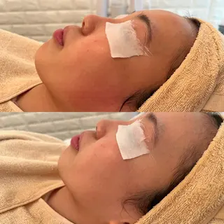 毛穴ケア/毛穴診断/ 毛穴洗浄〔心斎橋〕のエステ・リラクイメージ