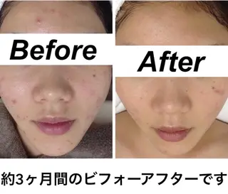 都度払い肌質改善 &脱毛Blancheのエステ・リラクイメージ