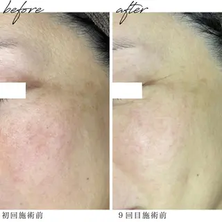 最新シミケアLily de pearlのエステ・リラクイメージ