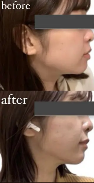 Moana【モアナ】 KARIN🫧のエステ・リラクイメージ