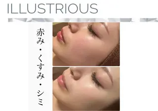fallon beautyのエステ・リラクイメージ