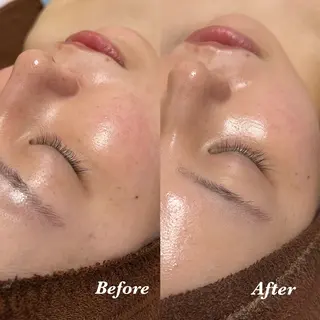 ๐๐๐๐ก๐ ๐๐ฒ ๐๐๐ฒ๐ฎๆๅฑใปใใผใใใผใชใณใฐ๐ฟ ๐ด๐๐๐ใฎใจในใใปใชใฉใฏใคใกใผใธ