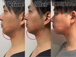 六本木/似合わせ眉毛 andＳ🍀Yuriのエステ・リラクイメージ