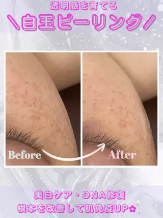 レイビス盛岡店 ♡吉田♡のエステ・リラクイメージ