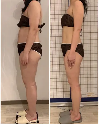 リンパマッサージ&ピラティスmimoza所属・リンパマッサージ mimozaのエステ・リラクイメージ