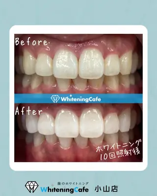 ホワイトニングカフェ 小山店のエステ・リラクイメージ