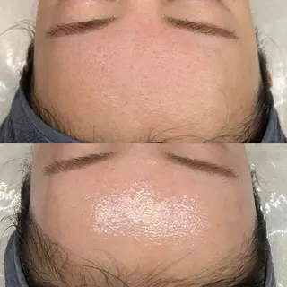 韓国🇰🇷価格 サロン_Nbibiのエステ・リラクイメージ