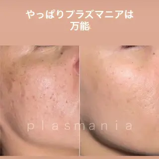 肌質改善｜エステ Connect ゆいのエステ・リラクイメージ