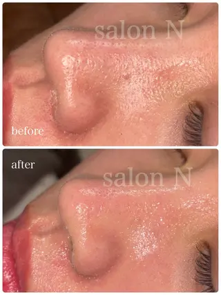 salonＮ所属・星野 マリアのエステ・リラクイメージ