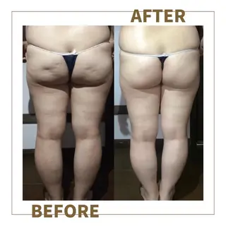 VICTOIRE MARUYAMAのエステ・リラクイメージ