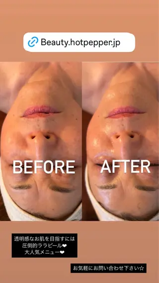 VERY VERY九条店所属・肌育ララピール🌹 VERY VERYのエステ・リラクイメージ