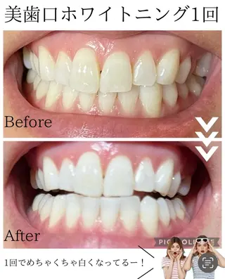 エステ／ネイル/脱毛 R.Msalonのネイルデザイン