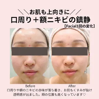 PRETTIEST SHINE所属・山田 浩子のエステ・リラクイメージ