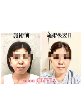 salon CLIVIA, クリヴィア所属・無痛小顔矯正 クリヴィアのエステ・リラクイメージ